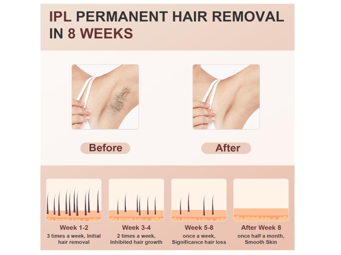 Depiladora IPL Pro | Luz Pulsada para Eliminación Permanente del Vello | CHRONUS T27S