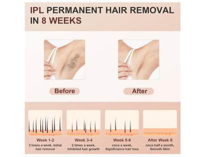 Depiladora IPL Pro | Luz Pulsada para Eliminación Permanente del Vello | CHRONUS T27S